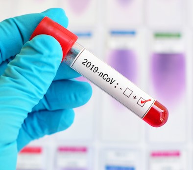 COVID-19: Tại sao một số người bị nặng, số khác không thấy triệu chứng