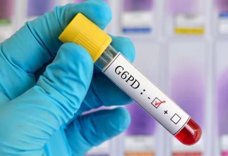 Sự thiếu hụt G6PD có liên quan đến nhiễm COVID-19 không?