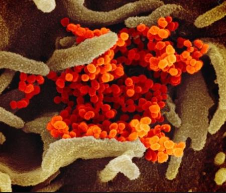 Protein interferon "phản loạn" trong cơ thể, kẻ mở cổng thành đón giặc SARS-CoV-2 vào trong tế bào