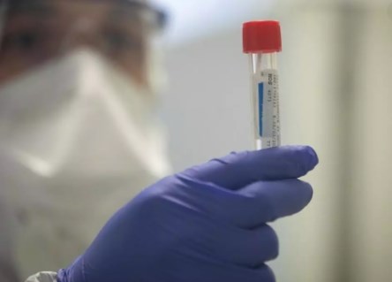 `COVID-19: Hà Lan` Phát hiện 3% dân số có kháng thể chống virus SARS-CoV-2