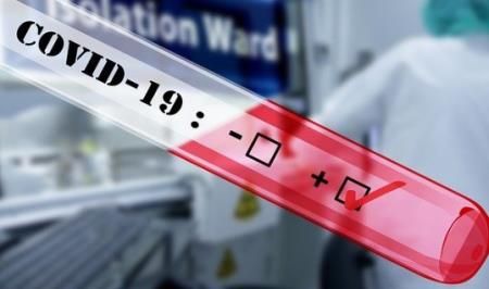 WHO cảnh báo tín hiệu mới nhất khó đoán về dịch bệnh Covid-19