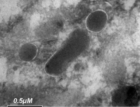 Phát hiện về sinh vật sống trong tế bào ung thư