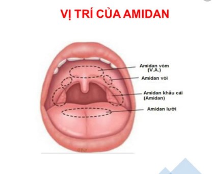 Nạo VA gây suy giảm miễn dịch cho trẻ?