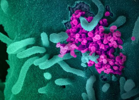 Biến chủng SARS-COV-2 mới ở Nam Phi nguy hiểm thế nào?