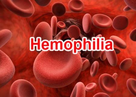 Lưu ý khi tiêm vaccine COVID-19 với người rối loạn đông máu và rối loạn chảy máu