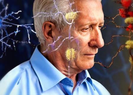 Loại Thuốc mới thử nghiệm cho thấy tiềm năng chống lại bệnh Alzheimer