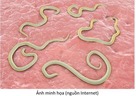 NHIỄM GIUN: HIỂM HỌA TỪ THÓI QUEN ĂN UỐNG, SINH HOẠT ĐẾN VẬT NUÔI