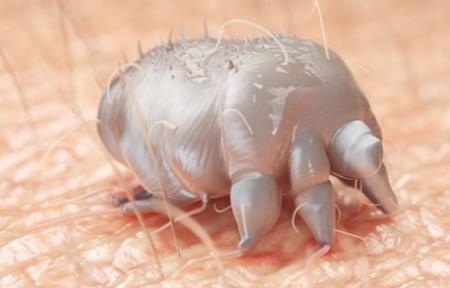 Ngứa dữ dội về đêm: rất có thể bạn đã bị ghẻ!