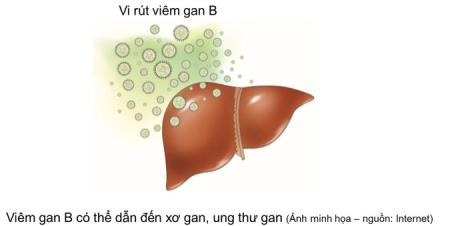 VIÊM GAN B (HBV); Ở VIỆT NAM CHIẾM TỈ LỆ CAO 