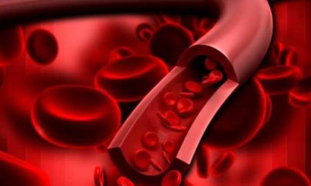 Mục tiêu điều trị mới cho bệnh tim được tìm thấy trong thành mạch máu