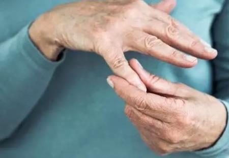 Viêm đa khớp là gì, nguyên nhân, yếu tố nguy cơ và điều trị
