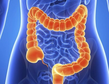 Khắc phục tình trạng kháng thuốc trong điều trị ung thư đại tràng