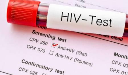 Nghiên cứu mới tiết lộ lý do tại sao HIV vẫn tồn tại trong mô người ngay cả sau khi điều trị bằng thuốc kháng vi rút