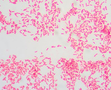 Các nhà nghiên cứu đã phát hiện ra cách vi khuẩn Gram âm kháng thuốc mở ra cách điều trị hiệu quả hơn