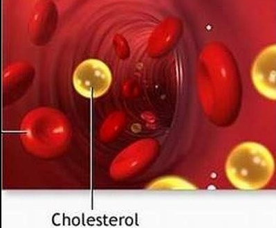Cholesterol trong chế độ ăn uống làm trầm trọng thêm tình trạng viêm, ốm