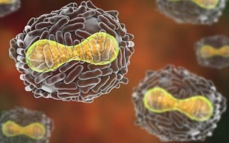 Đã xác nhận nguồn của bệnh đậu mùa hiếm gặp ở Anh