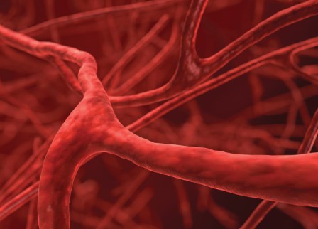 Phương pháp tiếp cận để khắc phục các bất thường về mạch máu gây ra các khối u khó điều trị