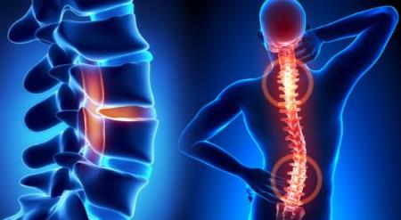 Cấy ghép thông minh để theo dõi quá trình lành cột sống