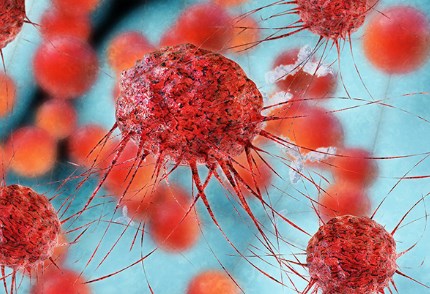 Một phương pháp điều trị hiệu quả hơn cho bệnh ung thư vú di căn đột biến HER2