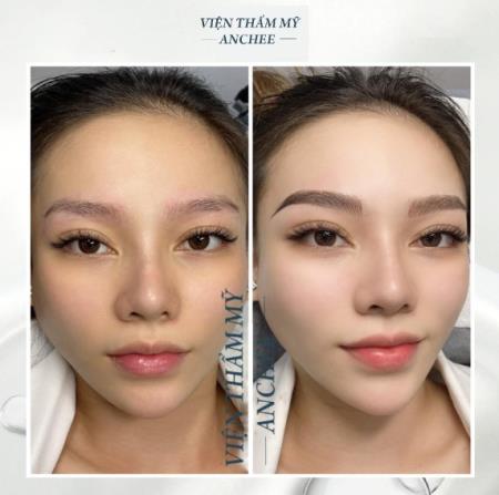 Phun xăm thẩm mỹ