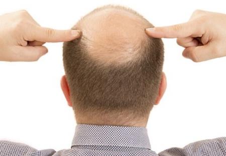 Phân tử tín hiệu kích thích mạnh sự phát triển của tóc