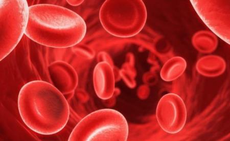 Tích tụ sắt trong não có liên quan đến nguy cơ rối loạn vận động