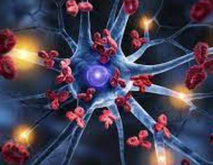 Các nhà khoa học phát triển cảm biến phát hiện sớm bệnh Alzheimer