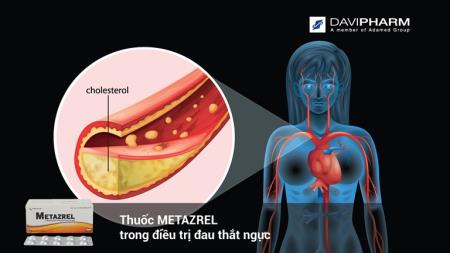 Thuốc METAZREL trong điều trị đau thắt ngực