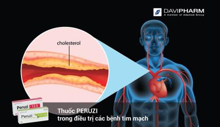 Thuốc PERUZI trong điều trị các bệnh tim mạch
