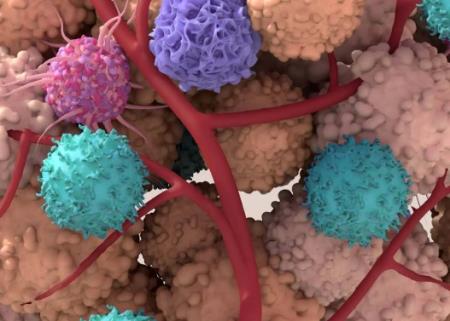 Tế bào ung thư sử dụng sự cạnh tranh của tế bào để trốn tránh khả năng phòng vệ của cơ thể như thế nào