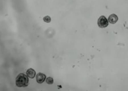 Các nhà khoa học chế tạo robot sinh học tí hon từ tế bào người