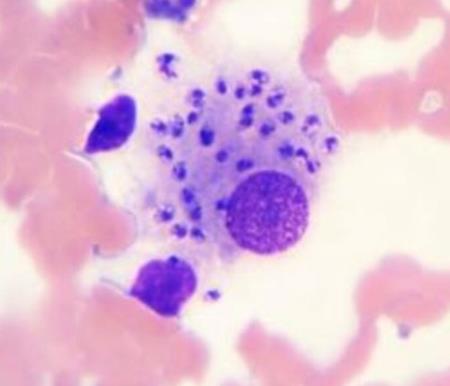 Khai thác sức mạnh của ký sinh trùng có thể ngăn chặn cơn đau