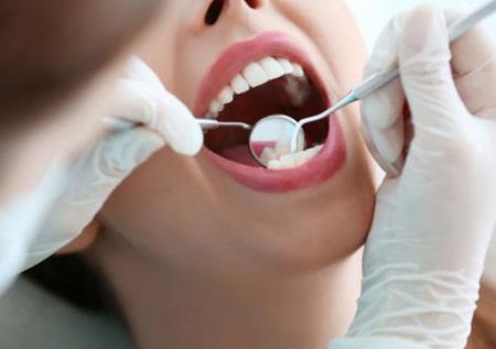 Vi khuẩn trong miệng có thể làm tăng nguy cơ mắc bệnh tim