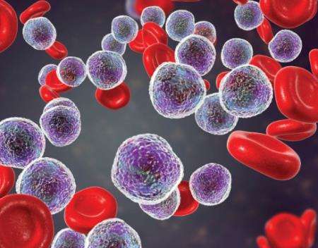 Phương pháp điều trị tiềm năng cho bệnh bạch cầu dòng tủy cấp tính