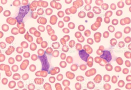 Bộ gen HIV ẩn trong các tế bào bạch cầu cung cấp mục tiêu mới để loại bỏ nhiễm trùng