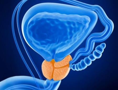 Chất ức chế mới được phát triển cho thấy tiềm năng trong điều trị ung thư tuyến tiền liệt