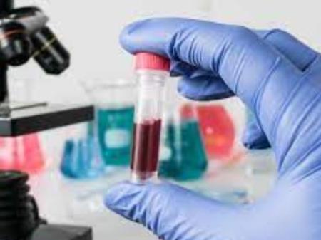 Cải tiến phương thức xét nghiệm máu để phát hiện và theo dõi ung thư