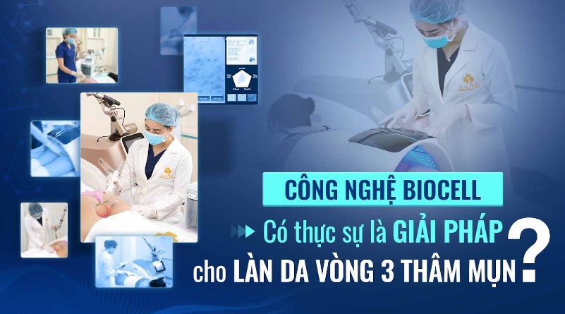 Công nghệ Biocell có thực sự là giải pháp cho làn da Vòng 3 Thâm Mụn?