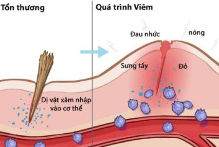 Các nhà khoa học xác định phần não mới ở chuột kiểm soát phản ứng viêm của cơ thể