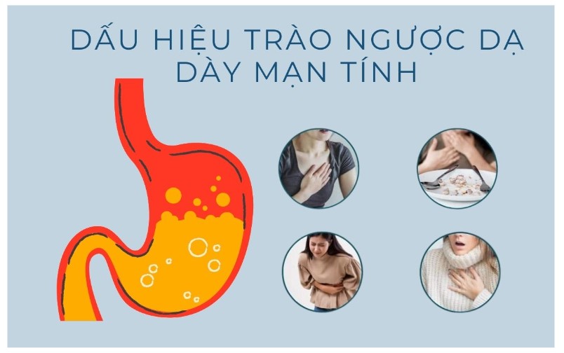 Dấu hiệu trào ngược dạ dày mạn tính và cách cải thiện bệnh nhanh chóng