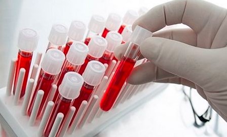 Xét nghiệm máu của Johns Hopkins phát hiện DNA khối u sớm ba năm