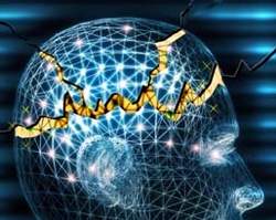 Cẩn trọng với các độc tính của thuốc chống động kinh valproat