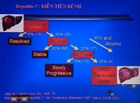 Chữa viêm gan siêu vi: Khổ do mù mờ thông tin