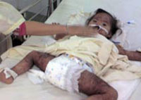 Một trẻ dị ứng thuốc nặng do người nhà tự điều trị
