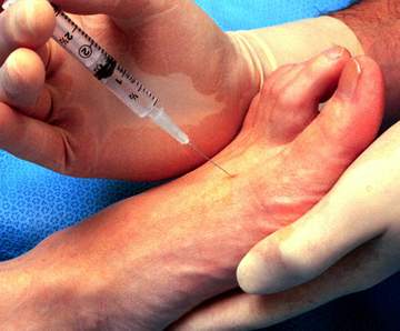 Thuốc gây tê, mê - Con dao hai lưỡi