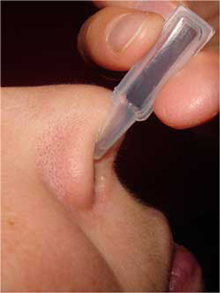 Tác hại của việc lạm dụng thuốc nhỏ mũi