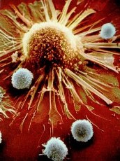 Prôtêin của người có thể giúp chống bệnh AIDS