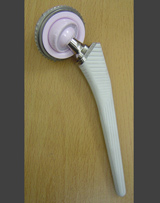 Thay khớp háng nhân tạo với công nghệ mới