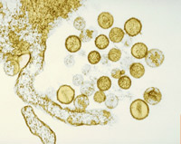 Phát hiện 1 protein khống chế vi rut viêm gan C