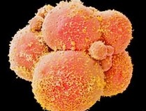 Xét nghiệm một lần biết 15 nghìn loại bệnh di truyền